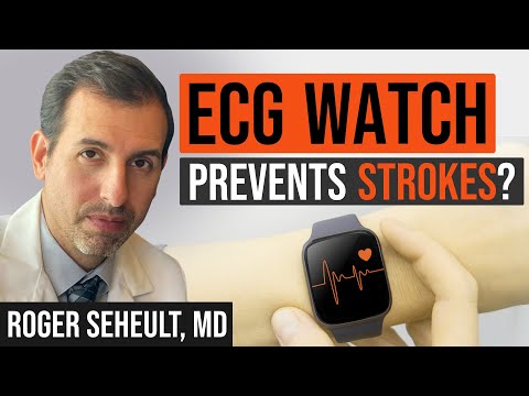 ECG Watch: How it Works (Apple, Samsung A fib Watches / EKG)